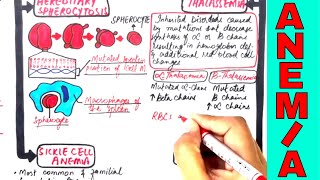 Types of Anemia Anaemia  Simplified Like Never Before [upl. by Brandes]