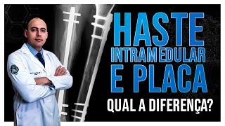 CIRURGIA ORTOPÉDICA  QUAL A DIFERENÇA ENTRE A HASTE INTRAMEDULAR E A PLACA [upl. by Erdnuaed]