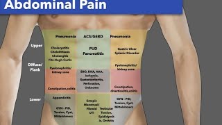 abdominal examination  فحص البطن [upl. by Misha348]