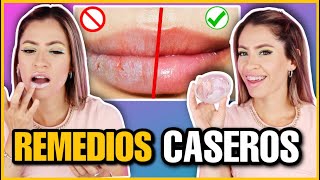 3 MASCARILLAS CASERAS PARA REPARAR LABIOS AGRIETADOS Y SECOS  NatyGloss [upl. by Yraillih308]