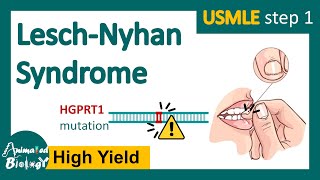 LeschNyhan syndrome  What are the symptoms of LeschNyhan syndrome  Treatment options  USMLE [upl. by Draw]