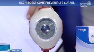 Il mio medico  Occhi rossi come prevenirli e curarli [upl. by Martainn]