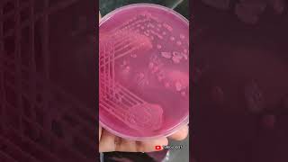 Macconkey agar  culture media  tjbiologist  biology  science  media streaking  medical [upl. by Zoltai]