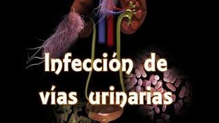 Infección de vías urinarias IVU [upl. by Niabi]