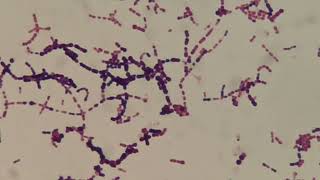 Gram positive bacteria becoming Negative [upl. by Ahtiekal]