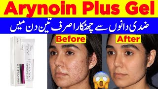 Arynoin Plus Gel 10g  Tretinoin Cream Treatment Of Cystic AcneSkin Care Glowing CreamAcne Cream [upl. by Riebling295]