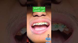 استك تقويم الأسنان اللون الأخضرGreen orthodontic stickshortvideo orthodontics drabdullahsultan [upl. by Farmer]