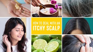 Itchy Scalp Treatments  Remedies For Dandruff Lice and Scalp Acne [upl. by Erasmo]