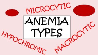 3 MAJOR TYPES OF ANEMIA [upl. by Vinn]