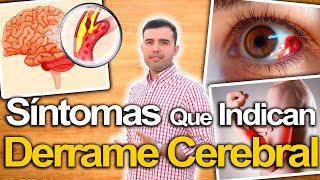 Ojo Con Estos Síntomas  Síntomas De Derrame Cerebral Y Cómo Prevenirlo Naturalmente [upl. by Barbe]