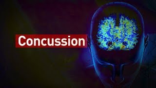 How do concussions affect the brain [upl. by Matland]