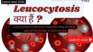 Leucocytosis pathology  Leucocytosis  Leucocytosis kya hota hai  Leucocytosis in hindi  WBC [upl. by Iphigenia]