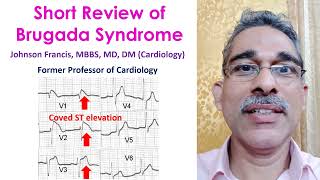 Short Review of Brugada Syndrome [upl. by Maggy127]