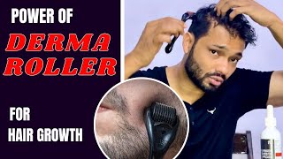 Derma roller for hair regrowth  dermaroller ka use kaise kare [upl. by Mosa]