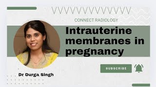 Intrauterine membranes in pregnancy [upl. by Sutphin754]