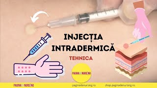 Injecția intradermică Tehnica AMG [upl. by Kelbee]