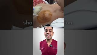 How Can You Fix A Dislocated Shoulder [upl. by Prudence]