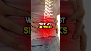 Can You Heal a Herniated Disc backpainrelief bobandbrad herniateddisc painrelief healthtips [upl. by Jonette]