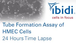 24h Phase Contrast Angiogenesis Assay of HMEC1 cells [upl. by Alekal454]