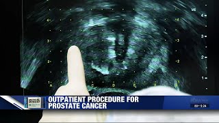 Medical Moment The nanoknife outpatient procedure for prostate cancer [upl. by Brittnee]