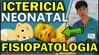 ICTERICIA NEONATAL FISIOPATOLOGÍA  GuiaMed [upl. by Pillihpnhoj769]