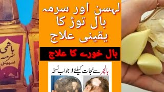 sukoontv  balchar ka ilaj  alopecia Areta treatment  balchara part 02 [upl. by Annod]