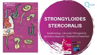 Strongyloides stercoralis Parasitology simplified tutorials For NEXT USMLE NEET PG PLAB [upl. by Sherman]