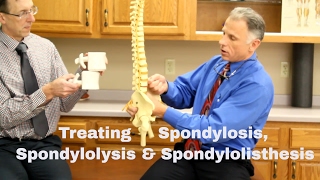 Treating Spondylosis Spondylolysis amp Spondylolisthesis Lumbar Spine [upl. by Kerns505]