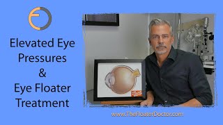 EYE PRESSURE ISSUES with YAG Laser Eye Floater Treatment Vitreolysis  Glaucoma  and [upl. by Verbenia]