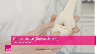 Kniearthrose einfach erklärt  Ursachen Symptome und Verlauf von Gonarthrose Arthrose im Knie [upl. by Ybhsa897]