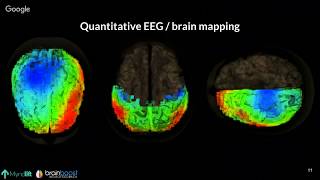 Fundamentals of Neurofeedback Webinar [upl. by Atinniuq]