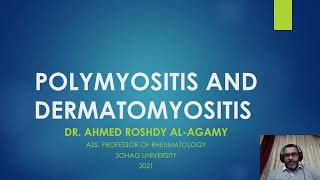 8 PolymyositisDermatomyositis PMDM [upl. by Epner]