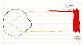 Why does a myope appreciate red color and a hyperope appreciate green color on Duochrome [upl. by Baggett]