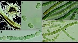 Cyanobacteria [upl. by Aramad]