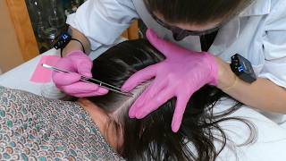 ASMR School Nurse LICE Check on Scalp and Neck  Lice Removal with a Comb and Tweezers Real Person [upl. by Nonnahsed]