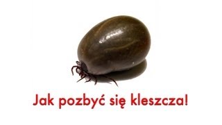 Kleszcz Poradnik jak usunąć kleszcza Wyjmowanie kleszcza [upl. by Inaoj]