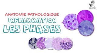 Anatomie Pathologique  Phases de lInflammation [upl. by O'Shee]