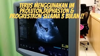 IVF Journey AzianampAiman EP15 2020 Aktiviti Kami Selepas positive 2WW [upl. by Oakes]