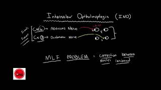 Internuclear ophthalmoplegia INO BASIC amp QUICK EXPLANATION [upl. by Enayd]