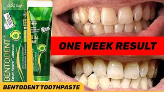 Bentodent natural toothpaste review bentodent toothpasteBentodent [upl. by Hobey]