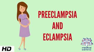 Preeclampsia and Eclampsia Causes Signs and Symptoms Diagnosis and Treatment [upl. by Doughman2]