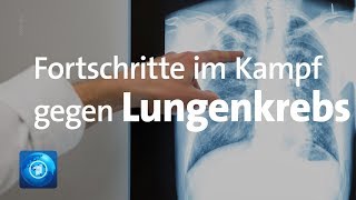 Fortschritte im Kampf gegen Lungenkrebs [upl. by Nyar145]