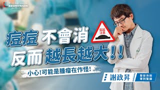 最新粉瘤手術衛教指南｜整形外科醫師詳細解說粉瘤治療方法！｜粉瘤手術｜表皮囊腫手術｜粉瘤切除手術｜ft謝政昇醫師 [upl. by Annecorinne]