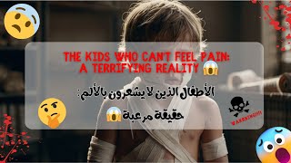 The Kids Who Cant Feel Pain A Terrifying Reality 😱 [upl. by Bevin881]