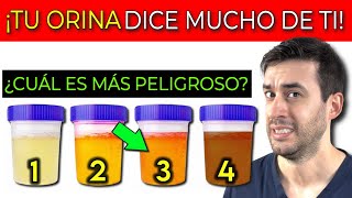 ¡Lo que tu ORINA DICE DE TU SALUD 4 SÍNTOMAS INICIALES de INSUFICIENCIA RENAL [upl. by Alrac]