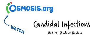 Candidal Infections Osmosis Study Video [upl. by Kentiga562]