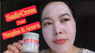 SUDOCREM  FOR ONE SKIN CARE SOLUTION  BEST ACNE KILLER MASK [upl. by Keynes]