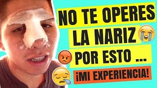 NUNCA LO HAGAS 😖  Cosas que ODIO DE MI CIRUGÍA DE NARIZ 😩 ¡NADIE TE LO DIJO [upl. by Nylekcaj]