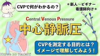 【CVPをイメージで理解しよう！】CVPが高い or 低いで何がわかるのか？ [upl. by Wilma]