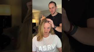 double hairline warning hair hairtransformation hairroutine rosemaryoil haircare hairgrowth [upl. by Thema137]